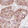 Anti-HSP60 Rabbit mAb