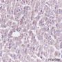 Anti-GLUD1 Mouse mAb