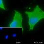 Anti-Calumenin Mouse mAb