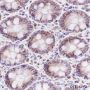 Anti-HSP10/EPF Rabbit mAb