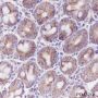 Anti-HSP10/EPF Rabbit mAb