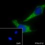 Anti-HSP10/EPF Rabbit mAb