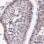 Anti-Muscarinic Acetylcholine Receptor 2 / CM2 Rabbit mAb