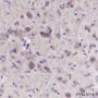 Anti-Muscarinic Acetylcholine Receptor 2 / CM2 Rabbit mAb