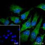 Anti-Cofilin-1 Rabbit mAb
