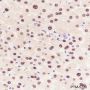 Anti-Arginase-1 Rabbit mAb