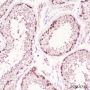 Anti-HSP90 beta Rabbit mAb