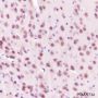 Anti-HSP90 beta Rabbit mAb