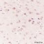 Anti-HSP90 beta Rabbit mAb