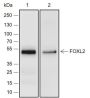 Anti-FOXL2 Rabbit mAb
