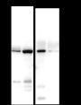 Anti-FOXA1 Rabbit mAb
