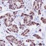 Anti-FOXA1 Rabbit mAb
