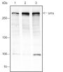 Anti-SPTB Rabbit mAb