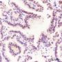 Anti-Phospho-CREB (Ser133) Rabbit mAb