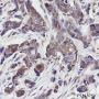 Anti-Calpastatin Rabbit mAb