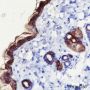 Anti-Keratin 1 Rabbit pAb