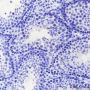 Anti-Keratin 1 Rabbit pAb