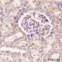 Anti-ATP5A1 Mouse mAb