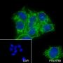 Anti-ATP5A1 Mouse mAb