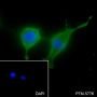 Anti-BMP6 Rabbit mAb