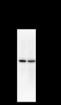 Anti-ACADM Rabbit mAb