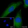 Anti-ACADM Rabbit mAb
