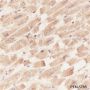Anti-alpha Actinin 2 Mouse mAb