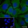 Anti-Phospho-S6 Ribosomal Protein (Ser235/236) Mouse mAb