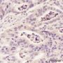 Anti-Aldolase A Rabbit mAb