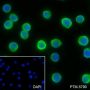 Anti-Aldolase A Rabbit mAb