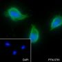 Anti-Activin A Receptor Type IB / ALK-4 Rabbit mAb