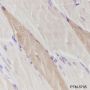 Anti-Myosin Light Chain 3 Mouse mAb