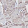 Anti-Myosin Light Chain 3 Mouse mAb