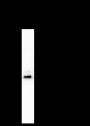 Anti-Keratin 19 Mouse mAb