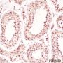 Anti-SF1 Rabbit mAb