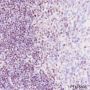 Anti-SATB1 Rabbit mAb