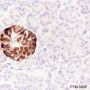Anti-Chromogranin A Rabbit mAb