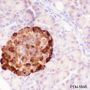 Anti-Chromogranin A Rabbit mAb