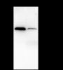 Anti-NF-kB p65 Rabbit mAb