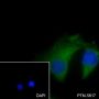 Anti-GCK Mouse mAb