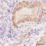 Anti-AMPK beta 1 Rabbit mAb