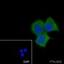 Anti-AMPK beta 1 Rabbit mAb