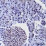 Anti-BMAL1 Rabbit mAb