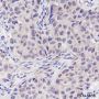 Anti-p44/42 MAPK (Erk1/2) Rabbit mAb