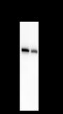 Anti-LPCAT1 Rabbit mAb