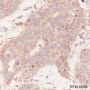 Anti-LPCAT1 Rabbit mAb