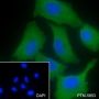 Anti-LPCAT1 Rabbit mAb