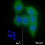Anti-LPCAT1 Rabbit mAb