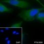 Anti-P4HA1 Mouse mAb