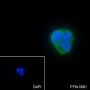 Anti-LDL Receptor Mouse mAb